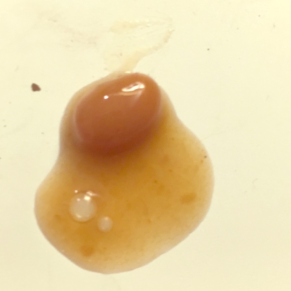 Bean